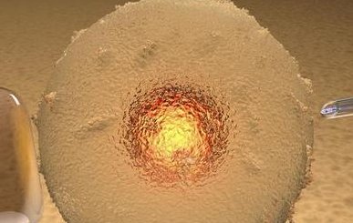 巧克力囊肿去马来西亚生丰医院做试管怎么样？附试管费用明细