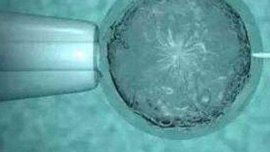 试管取精当天能不能吸烟？做试管抽烟有多大影响